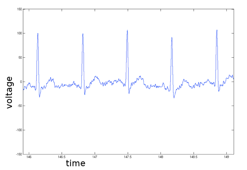 File:Simon heartbeat.png